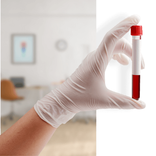 A weight loss doctors hand holding a vial of blood taken from a patient.